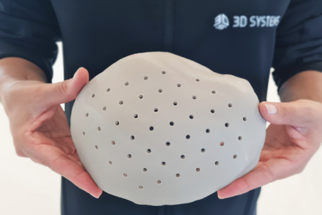 3D Systems erhält FDA-Zulassung für 3D-gedruckte PEEK-Schädelimplantate