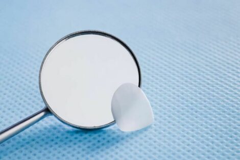FDA lässt UltraThineer von BMF für kosmetische Zahnverblendungen zu