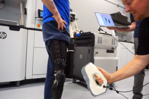3D-gedruckte Beinprothese